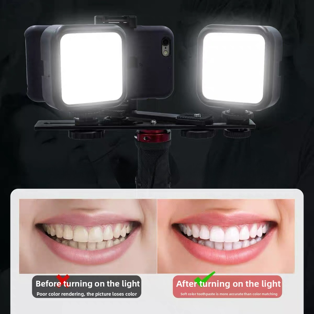 Photography Basics - Bluetooth搭載歯科用写真撮影ライト 口腔内写真照明 LED懐中電灯 腔内検査治療用モバイルランプ 充填ビデオ